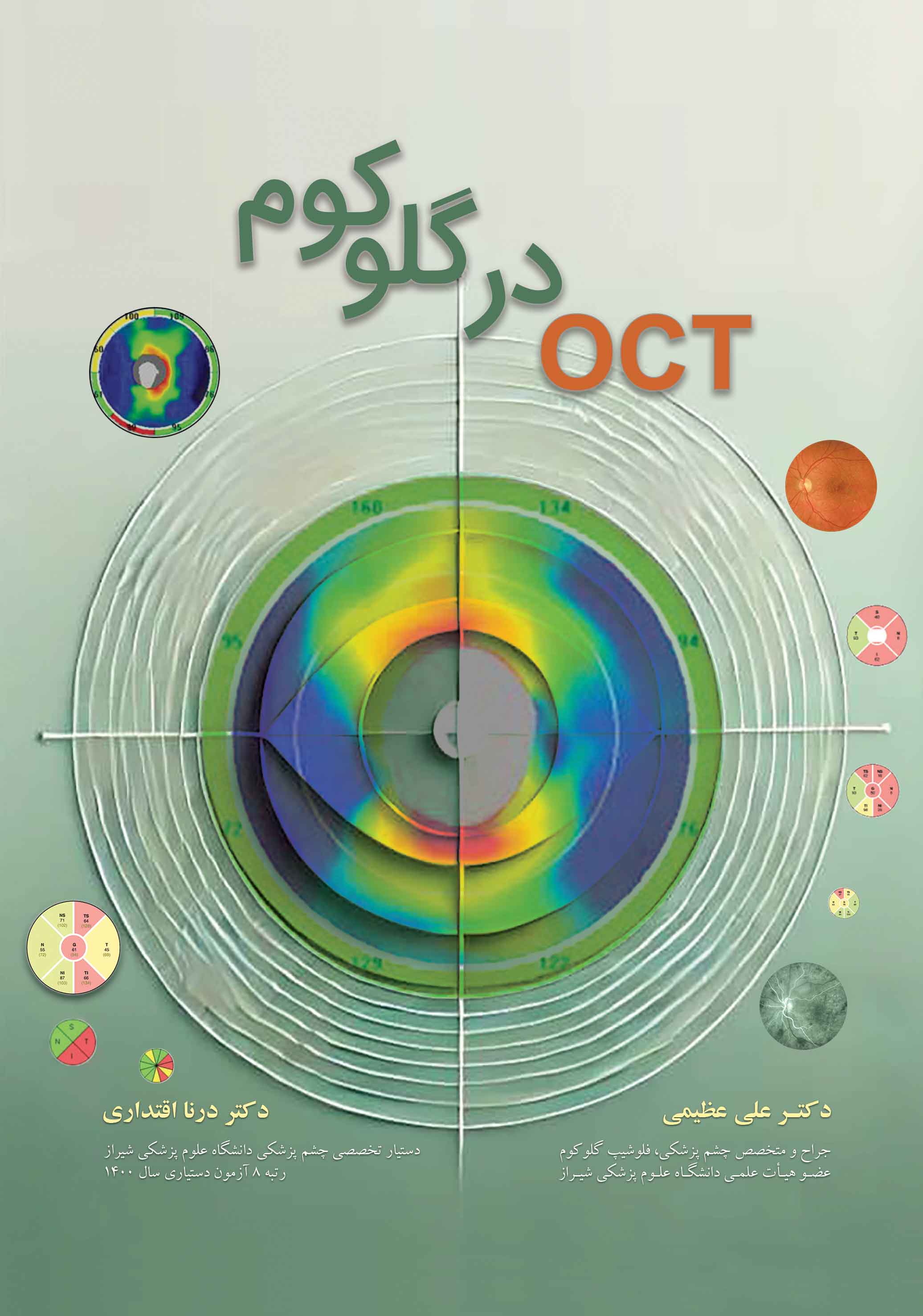 OCT در گلوکوم