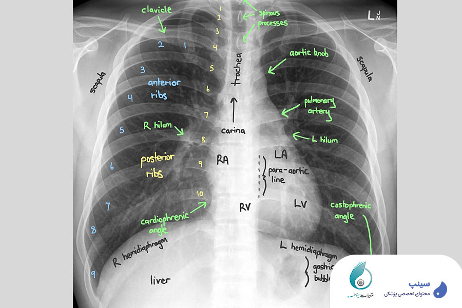  ریپورت نویسی سی تی اسکن شکم و لگن 
