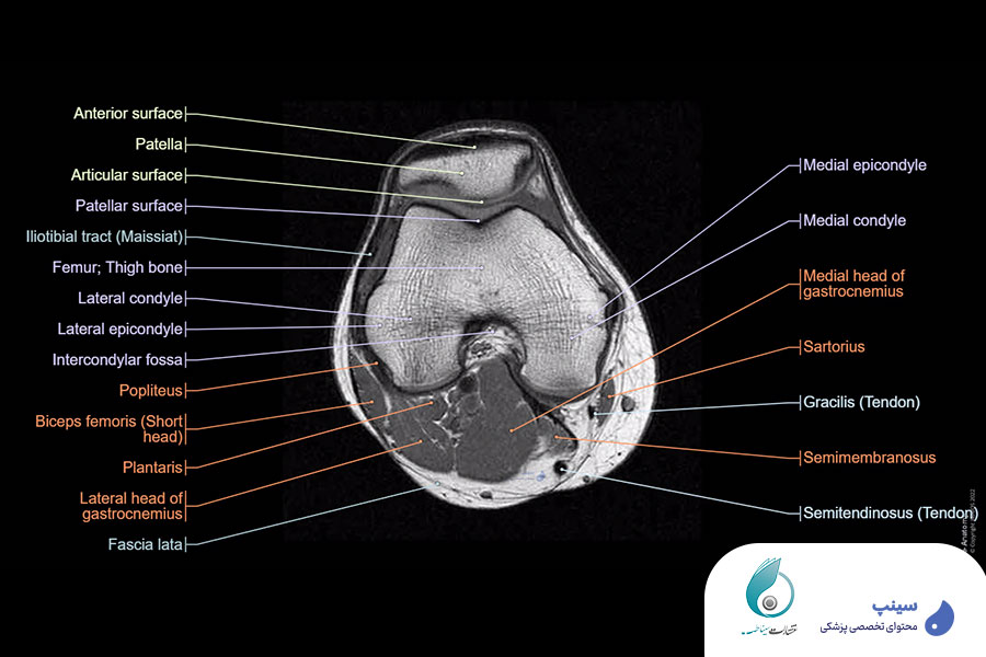 خرید دوره آناتومی زانو