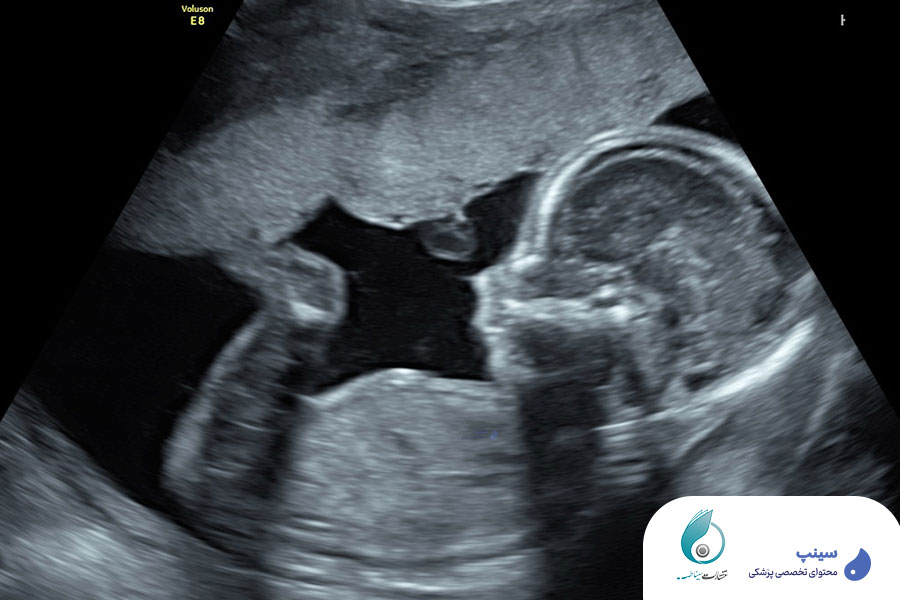 دوره آنومالی اسکن