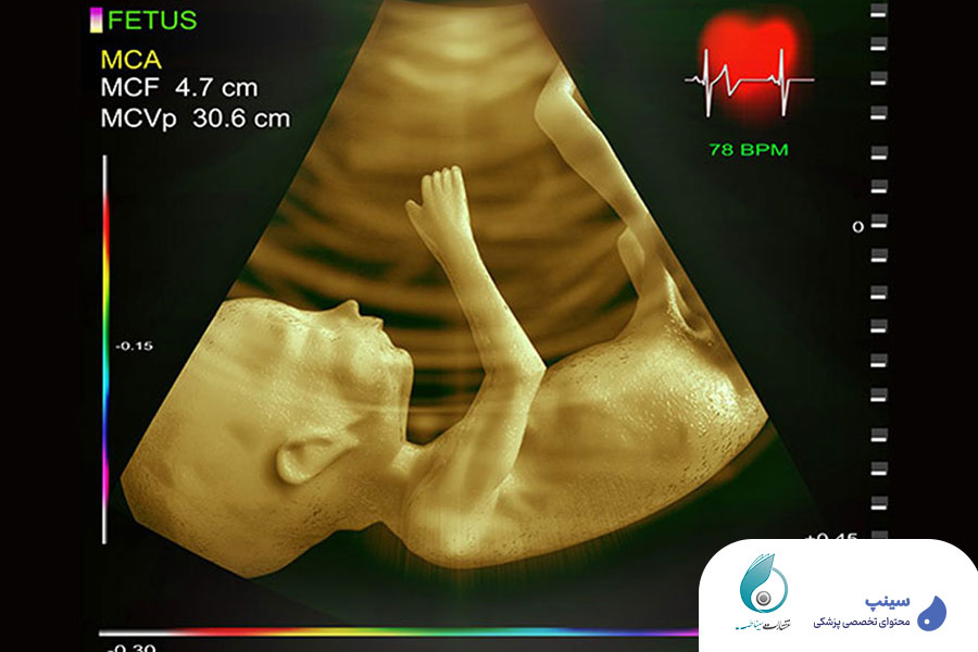 دوره-اکوکاردیوگرافی-قلب-جنین