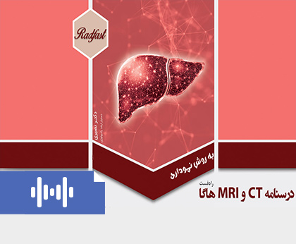 ویس درسنامه رادفست هاگا
