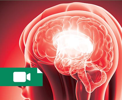 کلاس OSCE نورولوژی سال 96