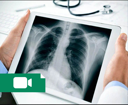 آموزش رادیولوژی و پرکتیکال گرافی قفسه سینه و استخوان 