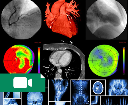 آموزش رادیولوژی پرکتیکال,سونوگرافی CT و MRI و x-ray (همه مباحث)