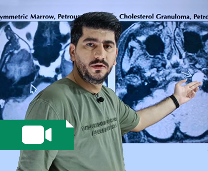 ریپورت نویسی CT و MRI مغز (از مجموعه میخکوب)