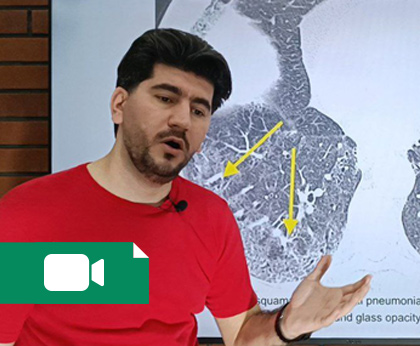 ریپورت نویسی سی تی اسکن ریه (از مجموعه میخکوب)