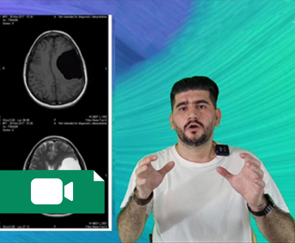 شناسنامه رادیولوژیک بیماری های CNS در سی تی اسکن و MRI